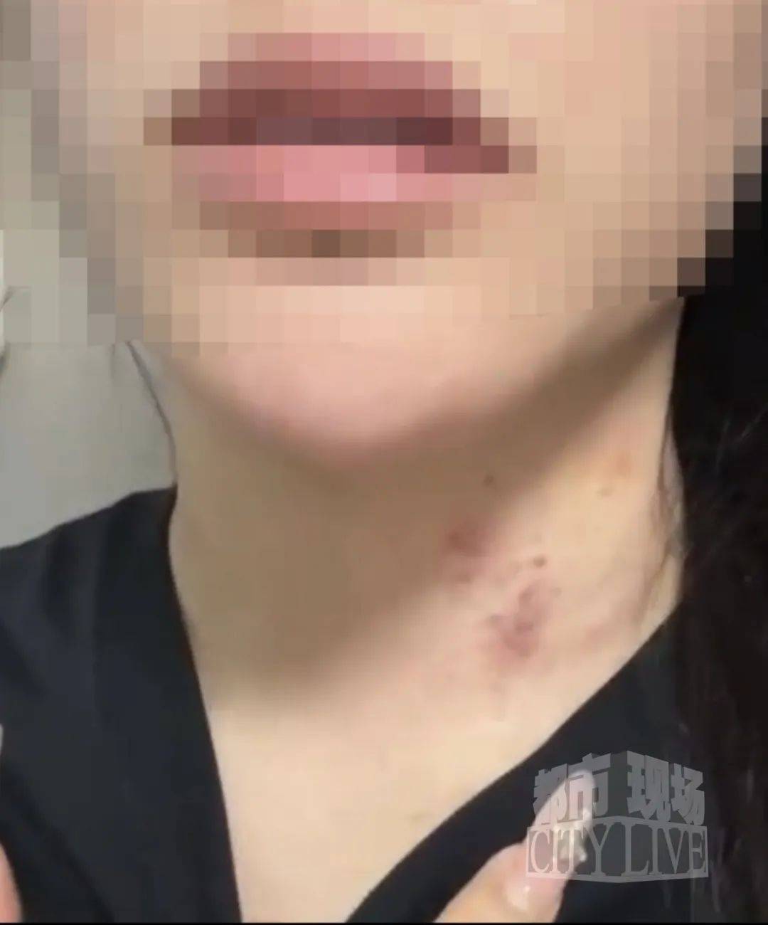 皇冠信用网代理流程_湖南衡阳29岁女子疑被男友施暴后从25楼跳下身亡 男友徐某此前还刺激说:“你放心皇冠信用网代理流程,她不会去死的”